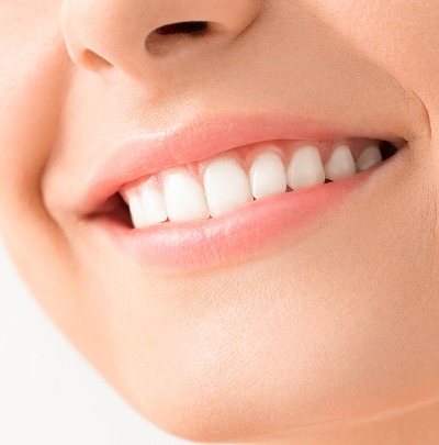 How to Fix an Overbite with Braces (How Long Does it Take?)