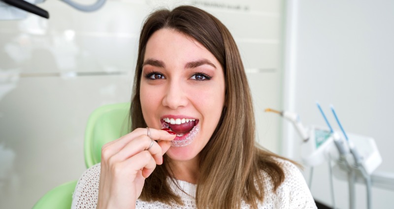 Which Looks Best - Clear Braces, Clear Aligners or Inside Braces?